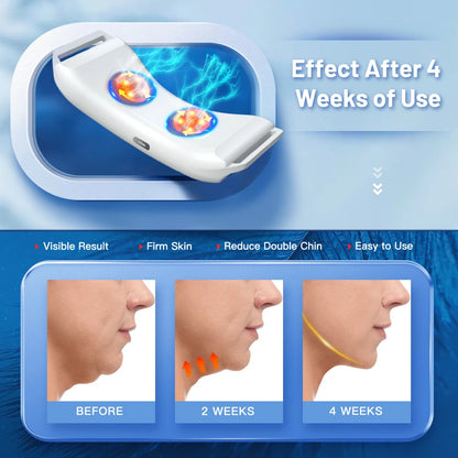 Vibration Face Lifter Device